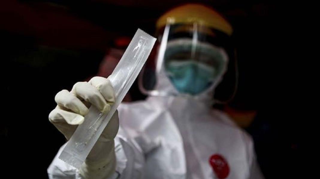 19 PNS Pemprov Jatim Positif Terinfeksi Virus Corona