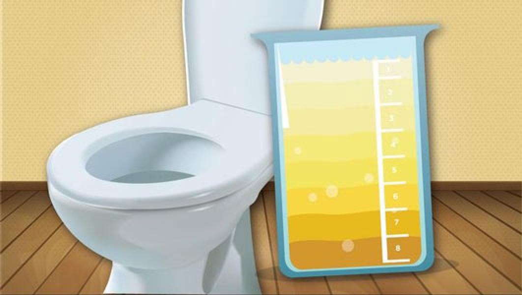 Ketahui Warna Urine dan Artinya untuk Ungkap Kondisi Tubuh