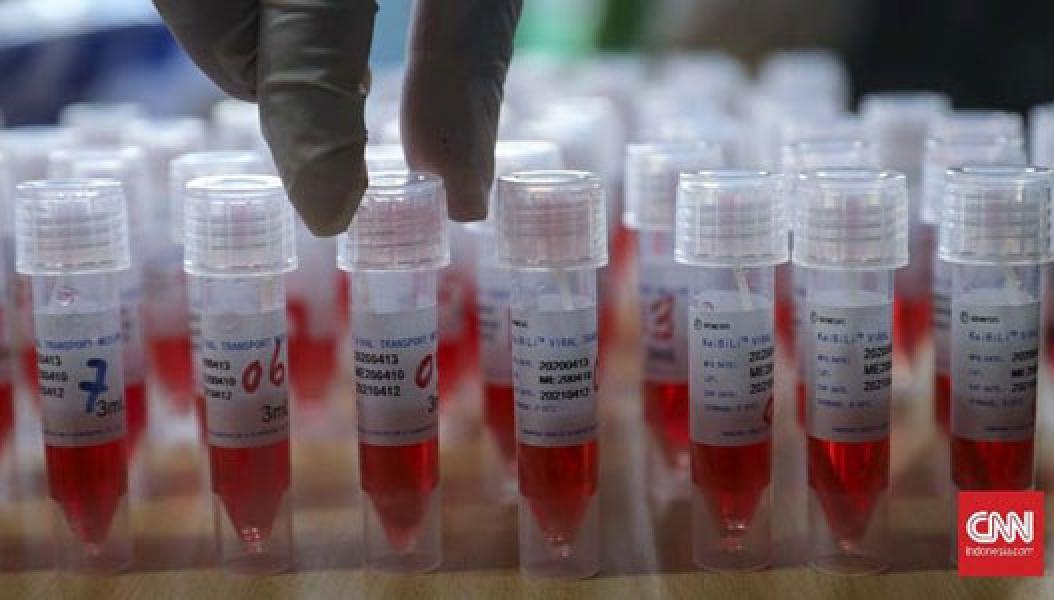 RSUD Soetomo: 12 Dokter PPDS Unair Positif Corona