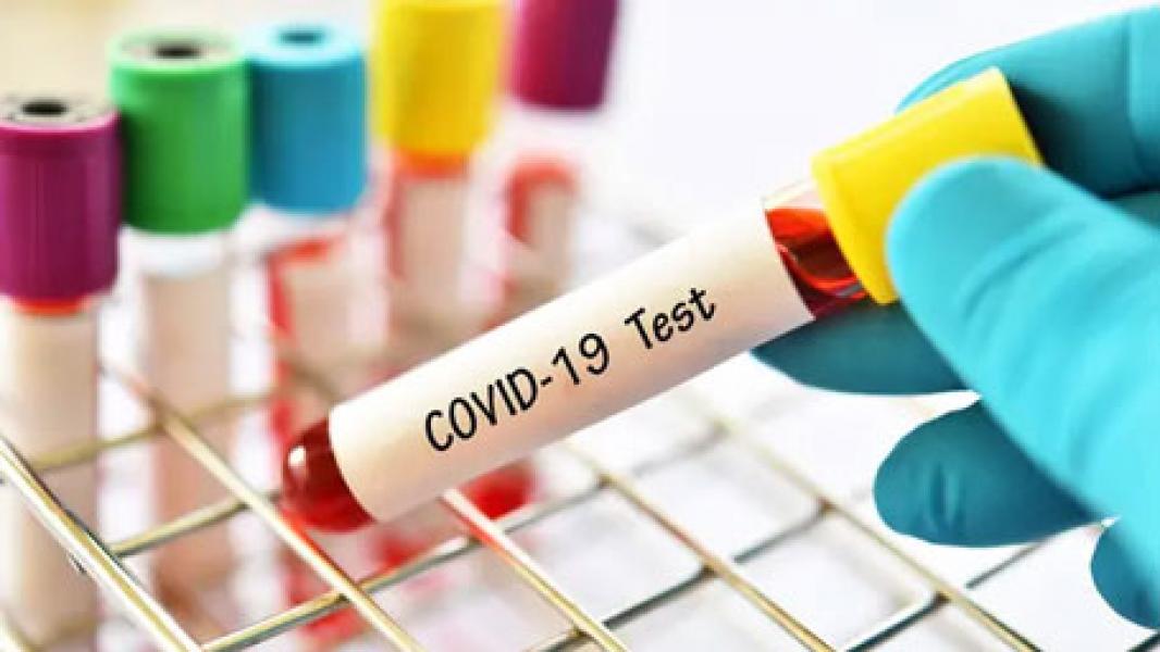 Melonjak Lagi, Covid-19 RI Per 16 Juni 2021 Positif Tambah 9.944 Kasus, Sembuh 6.229 orang