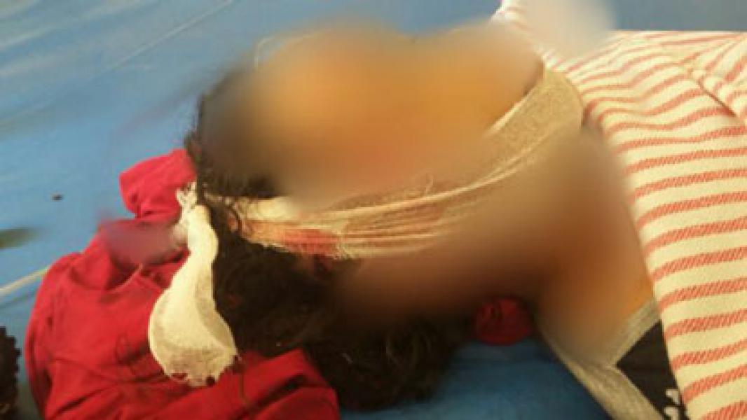Ditabrak dari Belakang Warga Siak Meninggal Dunia