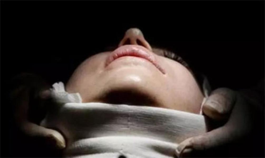 Ya Ampun! Perempuan China Operasi Plastik demi Hindari Tagihan Utang Rp50 Miliar