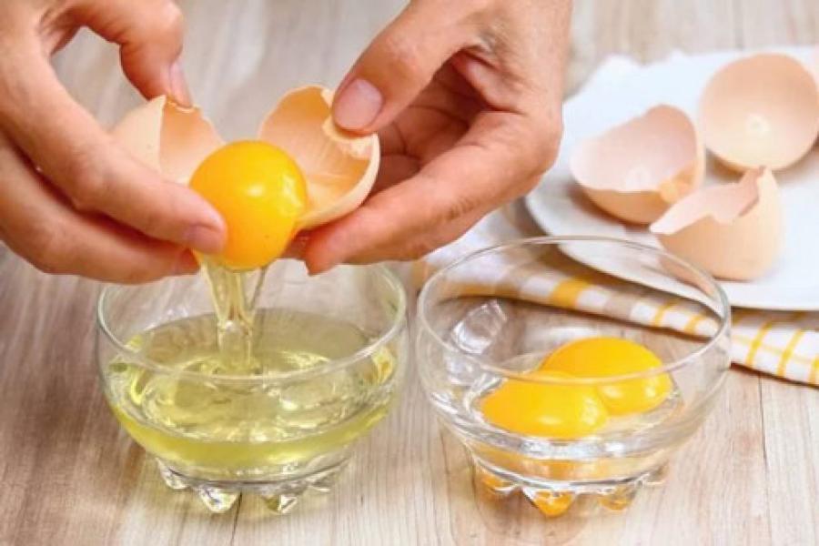 Berapa Jumlah Lemak yang Bisa Dikonsumsi Setiap Hari?