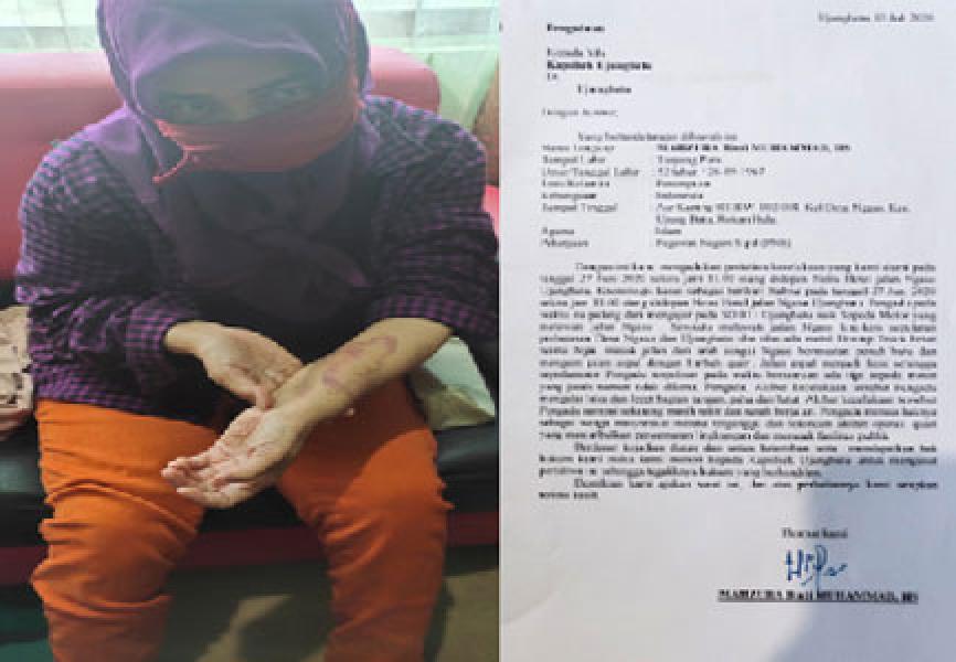 Material Berceceran di Jalan, Pengangkut Tambang Galian C di Rohul Makan Korban