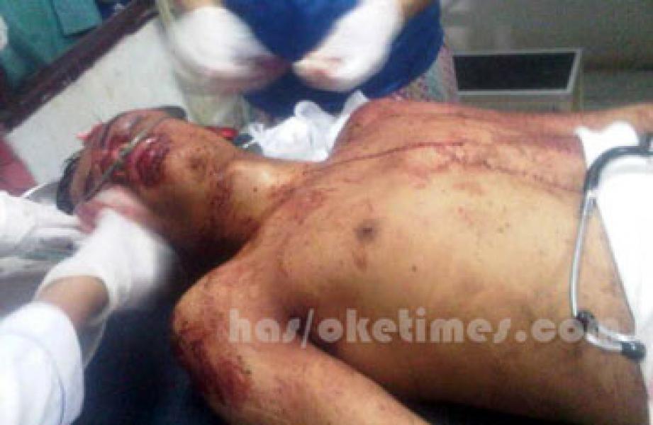 Curi Sepeda Motor, Pelaku Kritis Dihajar Massa