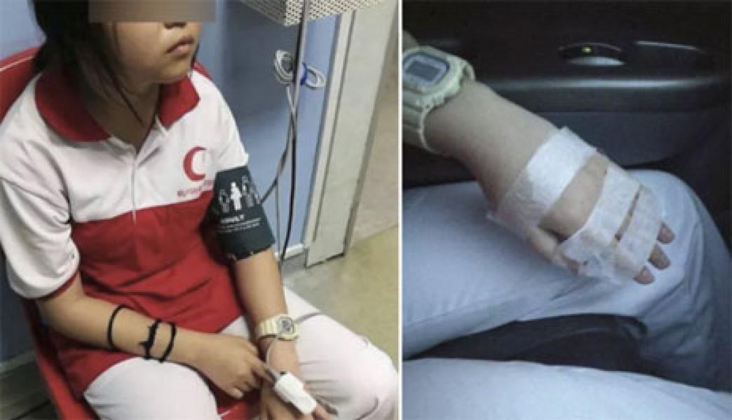 Kejam! Guru Ini Pukul Tangan Siswi SMP hingga Tulang Jarinya Retak