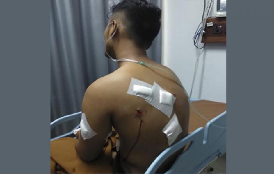 Asyik Main Gitar, ABG di Jalan Garuda Ditusuk OTK Hingga 12 Liang