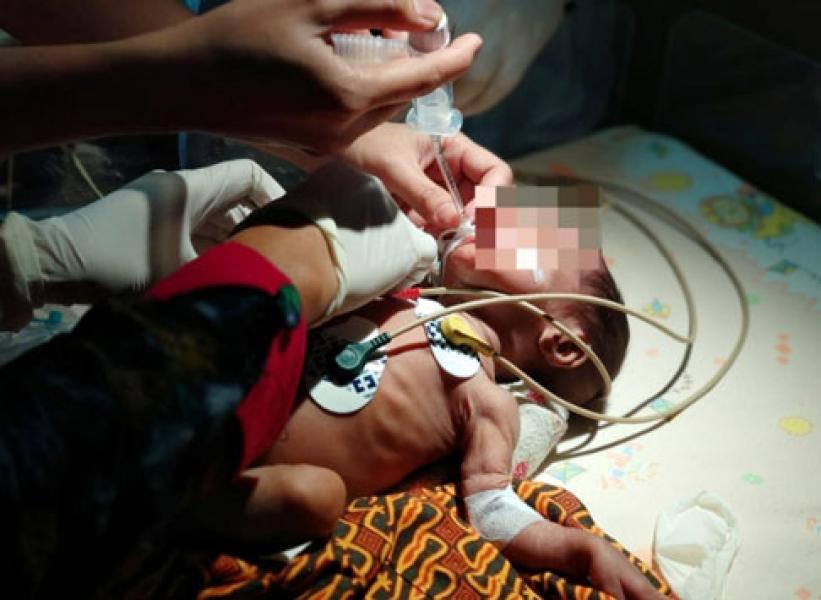 Terpapar Asap Kebakaran Hutan, Seorang Bayi Kritis