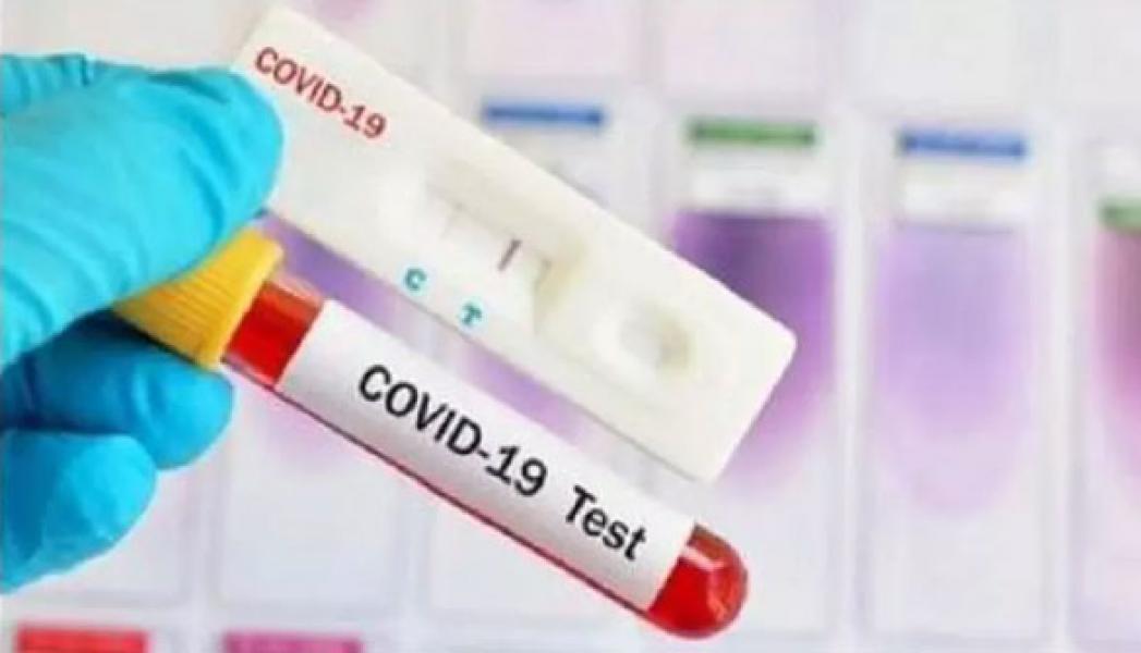 3 Agustus, Pasien Positif Covid-19 Indonesia Tambah 1.679 Jadi 113.134 Orang