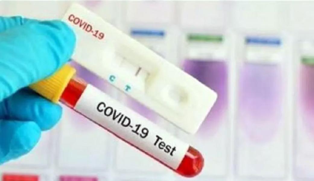 5 Agustus, Pasien Positif Covid-19 Tambah 1.815 Jadi 116.871 Orang