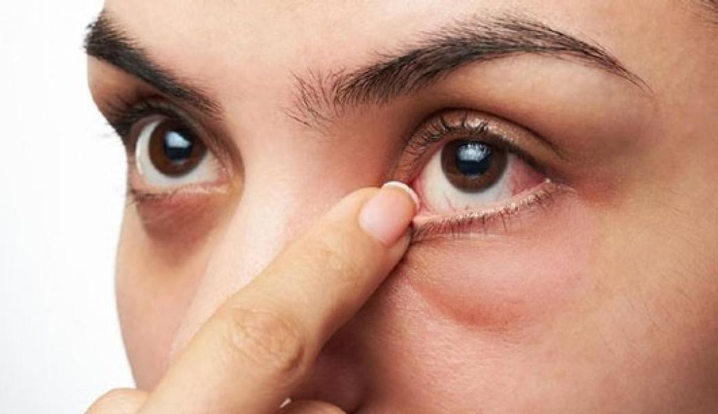 5 Tanda Masalah Kesehatan Serius pada Tubuh