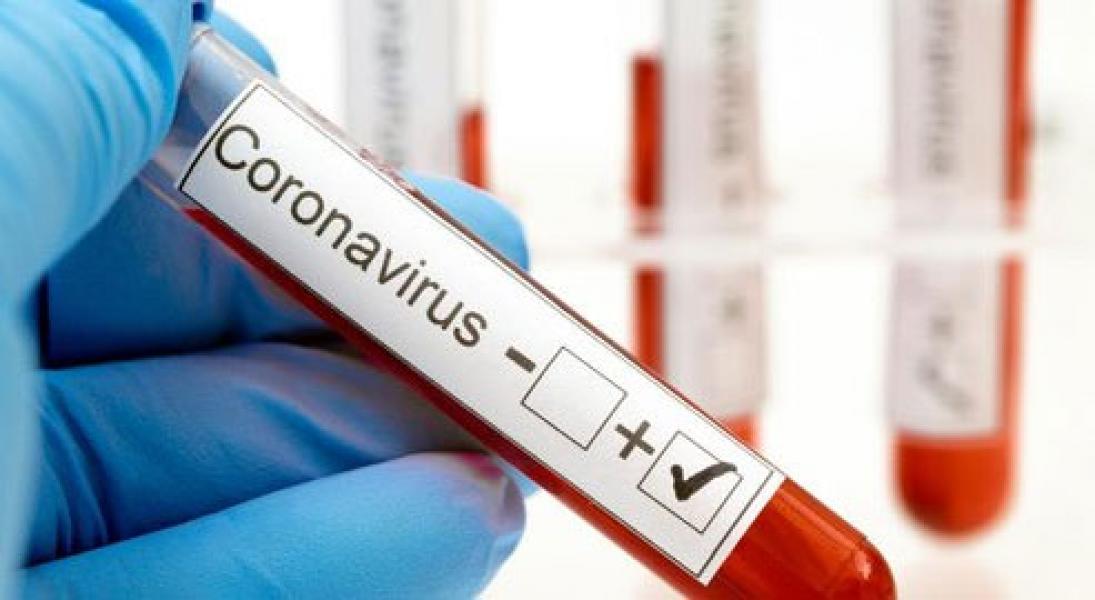 Ada Penambahan 15 Pasien, Positif Covid-19 di Siak Jadi 98 Kasus