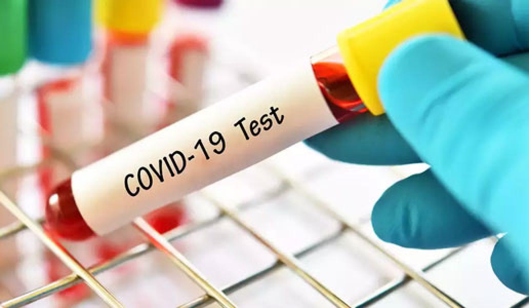 Pastikan Tidak Terkonfirmasi Covid-19, Seluruh PPDP Kandis Jalani Rapid Tes Sebelum Bertugas