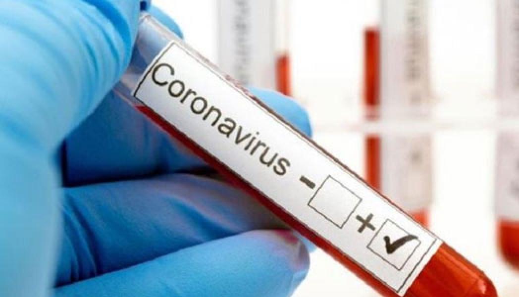 Waspada, Bernyanyi dan Berbicara Berisiko Tularkan Covid-19