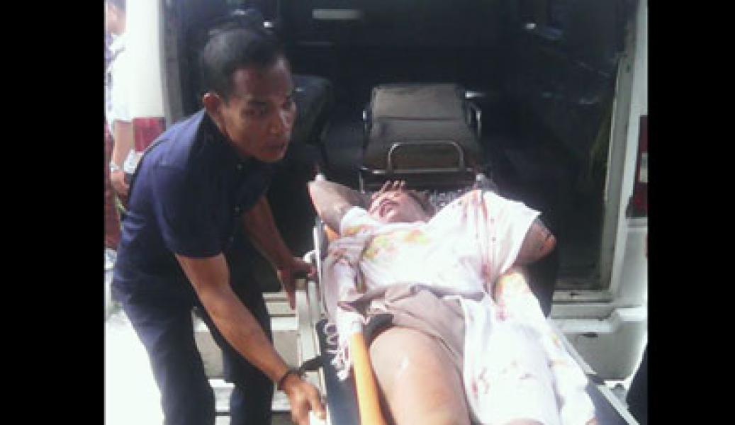 2 Korban Kebakaran di Pujasera Alang Dirawat Intensif