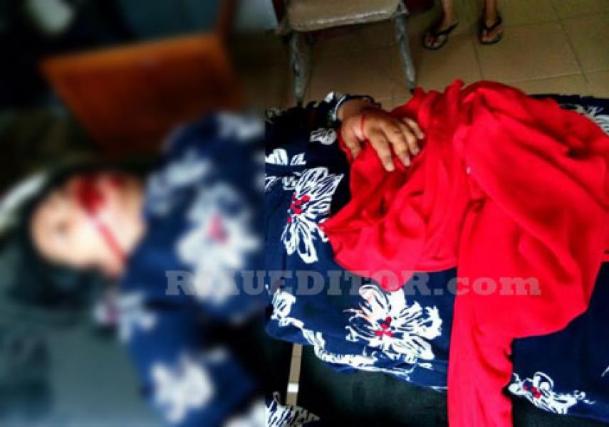 Cemburu Baca SMS, Suami Hantam Wajah Istri Pakai Palu