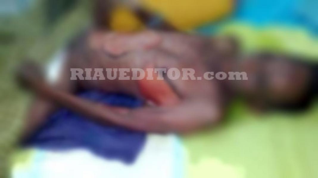 Pasien Operasi Katarak Gratis Meninggal Dunia Dalam Kondisi Mengenaskan