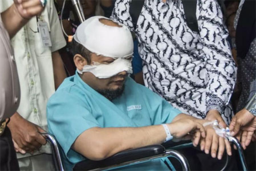 Direktur KPK Laporkan Novel Baswedan ke Polda Metro, Jaksa Teliti dan Pantau Penyidikan Kasusnya