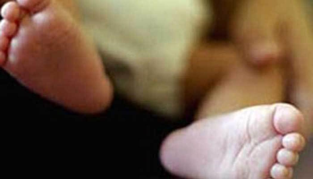 Geger, Bayi Bermata Satu dan Tak Punya Hidung Lahir di Indonesia