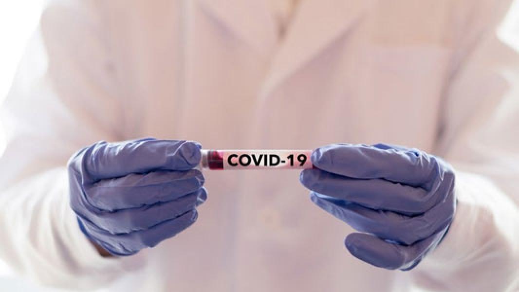 118 ASN Terpapar Covid-19, Pemprov Riau Minta Pegawai Terapkan Protokol Kesehatan