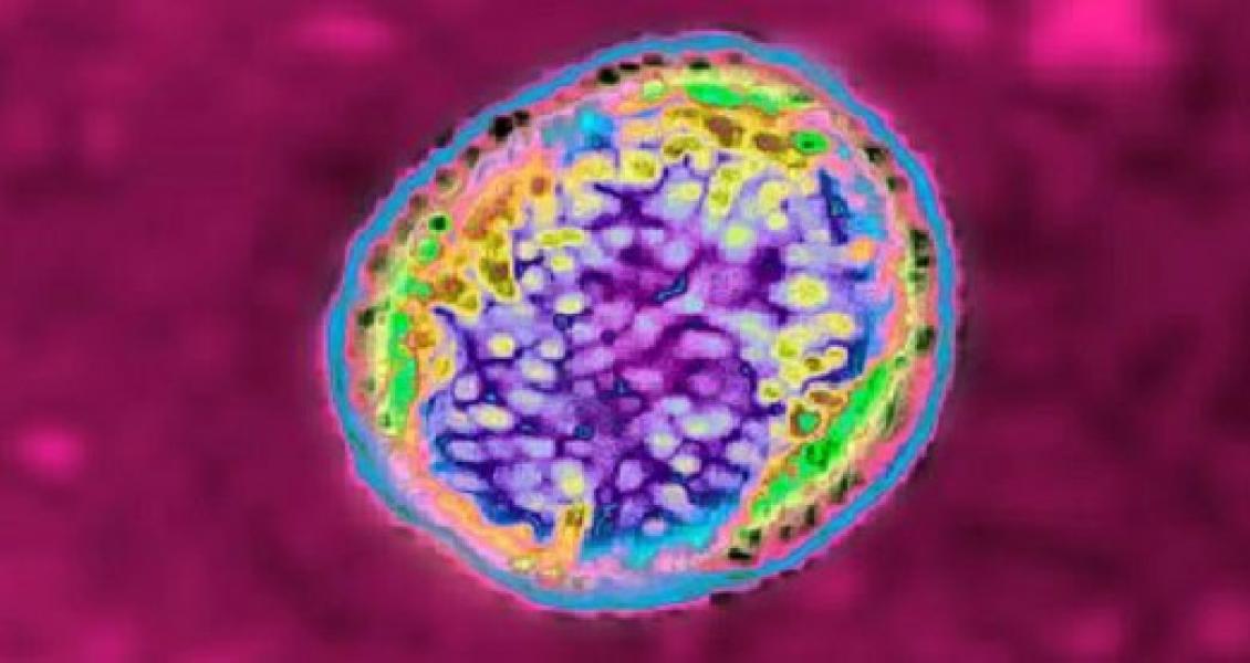 Laboratorium Perusahaan China Bocor, Ribuan Orang Terinfeksi Brucellosis
