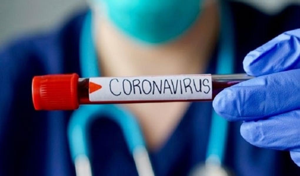 Update 18 September: Positif Covid-19 Bertambah 3.891 Jadi 236.519 Orang
