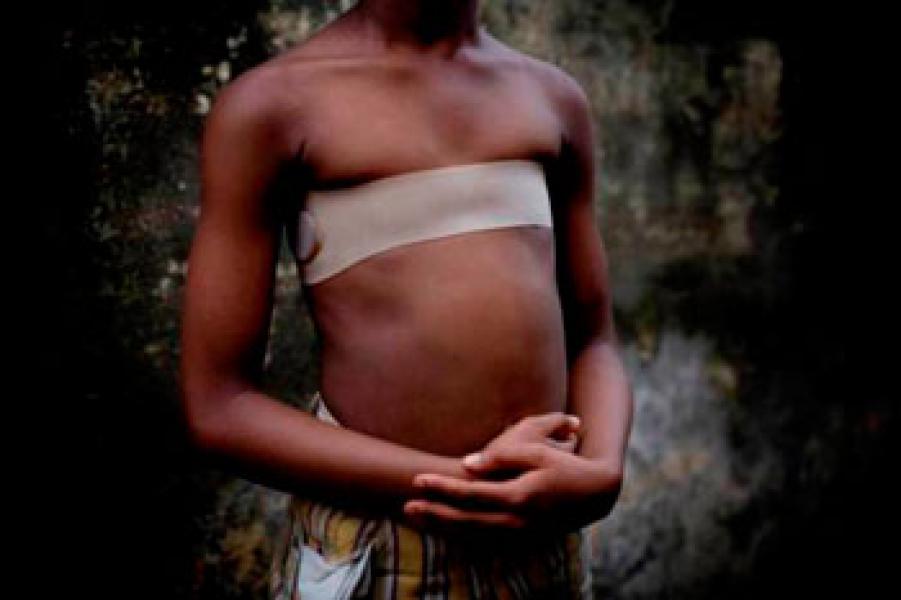 Ritual Setrika Payudara yang Mengerikan dari Afrika