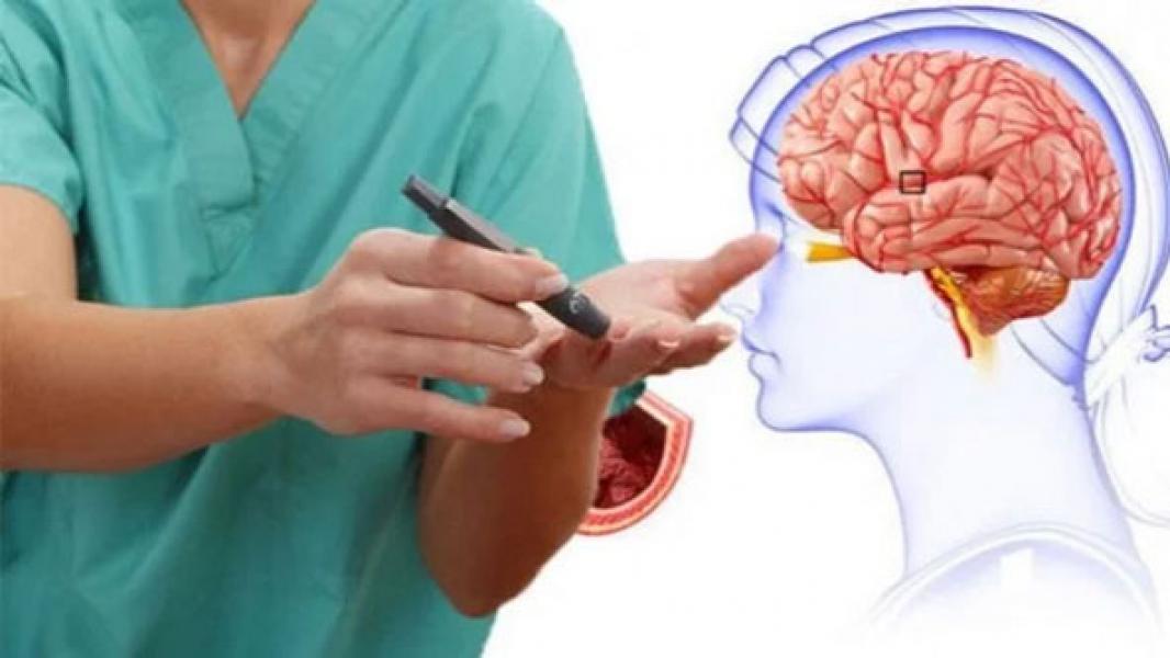 Orang Stroke Ditusuk Ujung Jarinya Bisa Sembuh, Hoax atau Fakta?