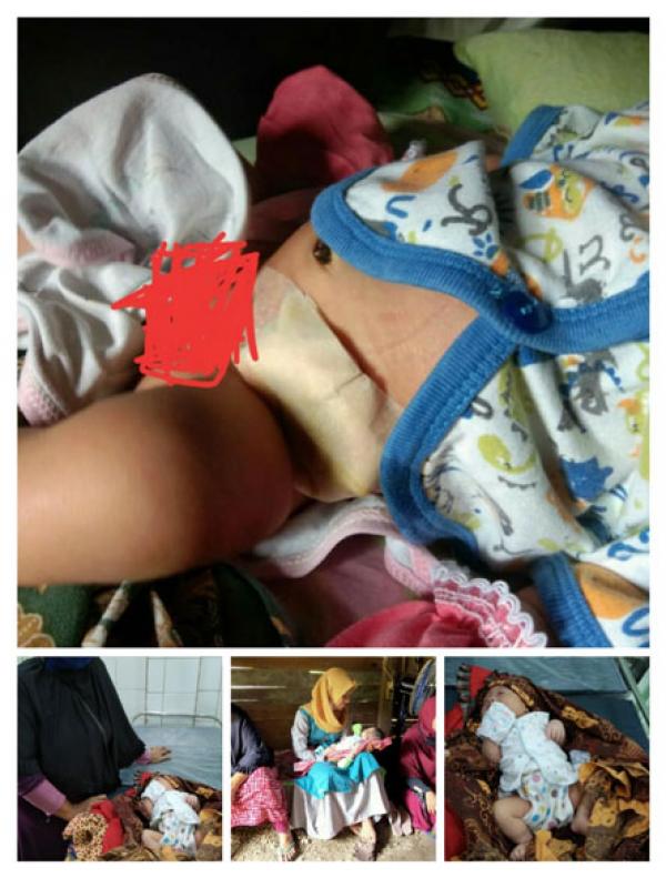 Asmah Nabila Balita Asal Ukui Kabupaten Pelalawan Riau Lahir Tanpa Lubang Anus, Butuh Uluran Dermawan 