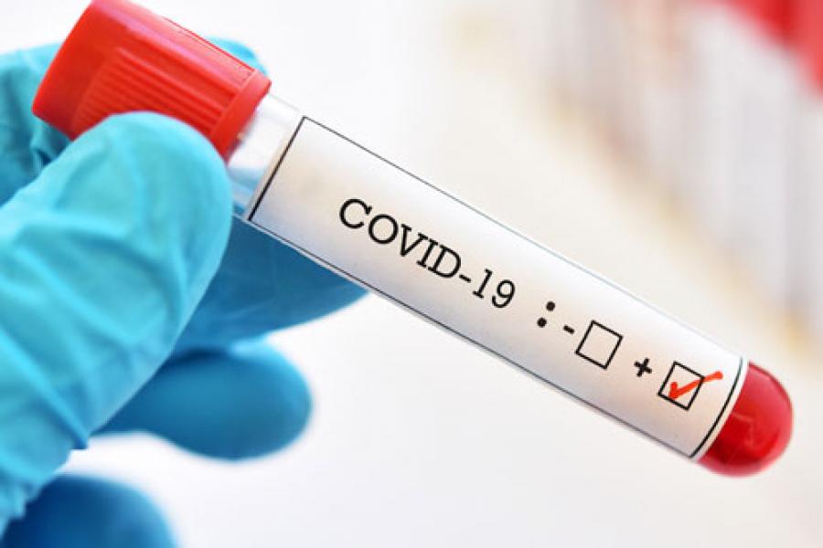 Positif Covid-19 Riau Hari Ini Bertambah 259 Kasus, 121 Pasien Sembuh