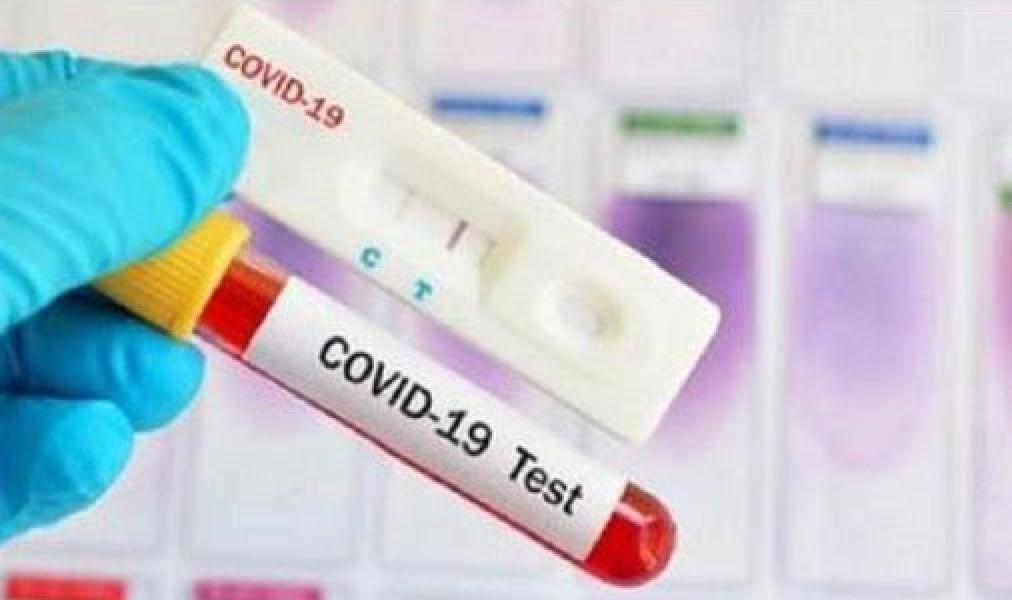 Update 23 Oktober 2020, Pasien Positif Covid-19 Tambah 4.369 Jadi 381.910 Orang