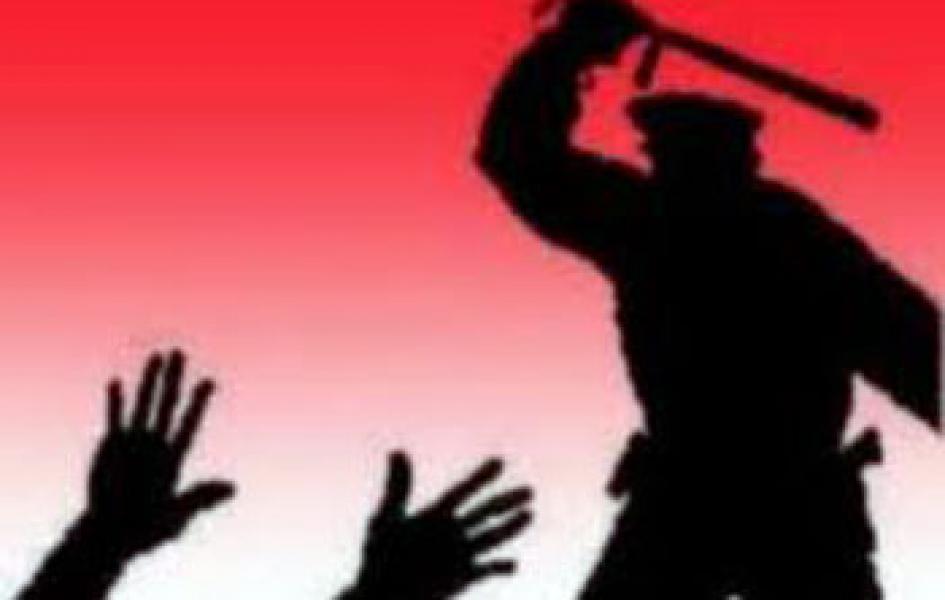 Dituding Pelaku Curanmor, Udrizal Babak Belur Dihajar Polisi