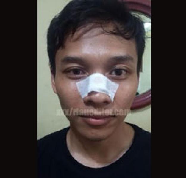 Seruduk Hidung Peserta, Seorang Pengamanan Kongres HMI Pekanbaru di Polisikan