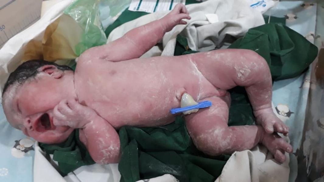 Heboh, Peserta Tes CPNS Melahirkan Setelah Ujian