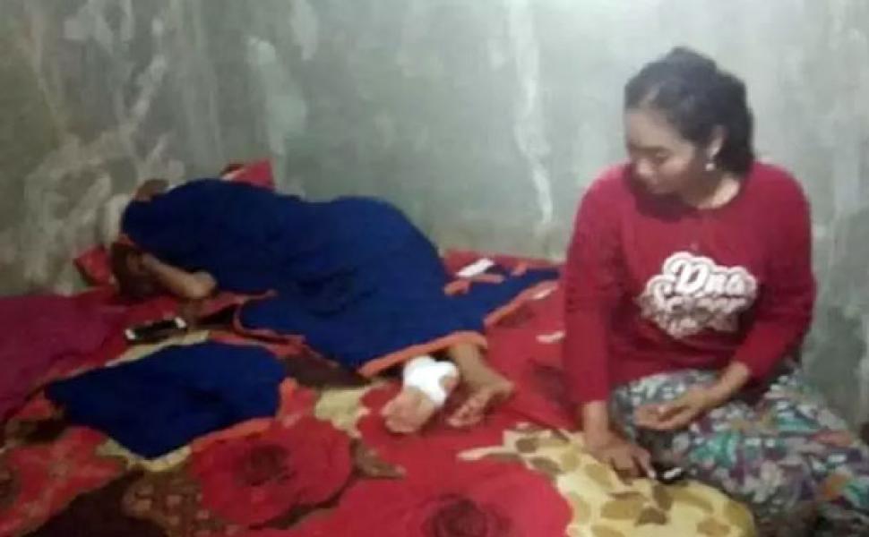 Siswi di Batang Dihukum Guru Jalan Jongkok Keliling Lapangan hingga Kakinya Melepuh