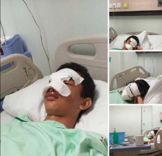 Viral Siswa SMPN 38 Dipukuli dan Dianiaya Temannya, Guru Sibuk Main Hp Beredar di Medsos