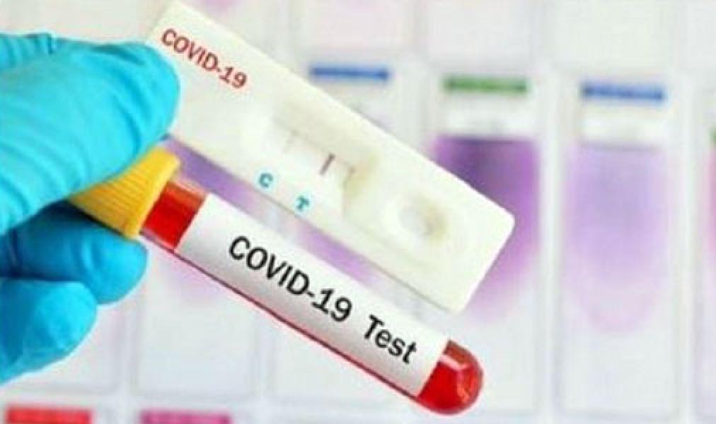 Bertambah 3.807 Kasus, Positif Covid-19 Jadi 474.455 Orang