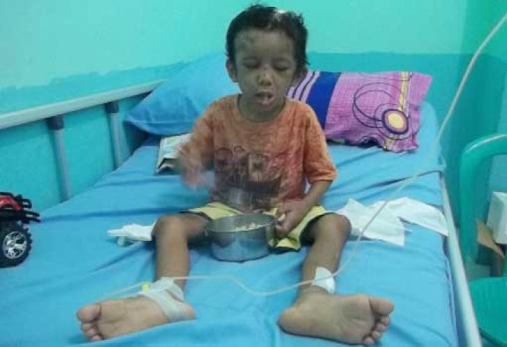 Punggung Bocah 6 Tahun Disetrika, Lidah Disilet