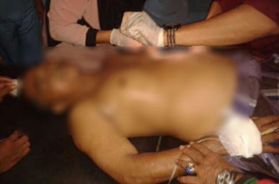 Warga Inhu Bersimbah Darah Diserang Kawanan Rampok Bersenpi