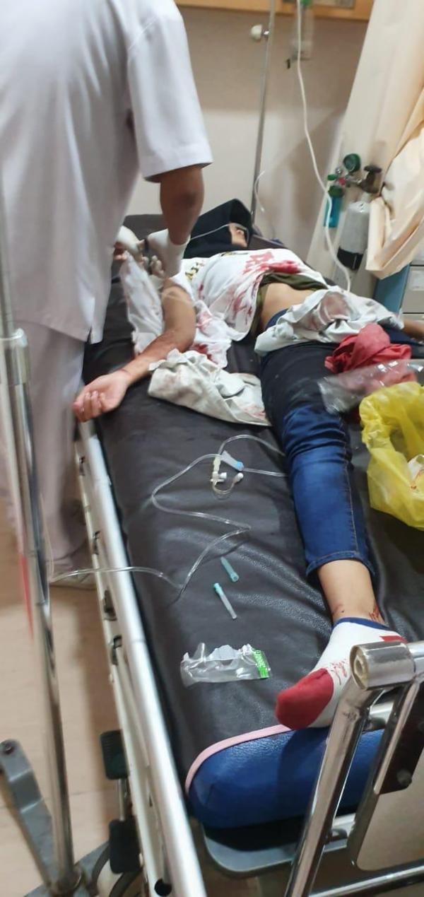 Diduga Depresi, Seorang Remaja Putri Potong Nadi Tangan Disebuah Mal di Pekanbaru
